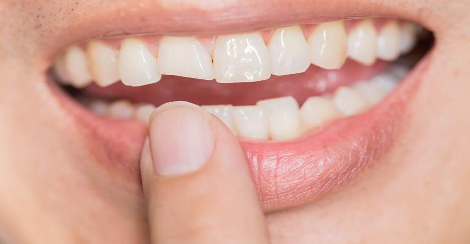 Cosmetic Dentistry