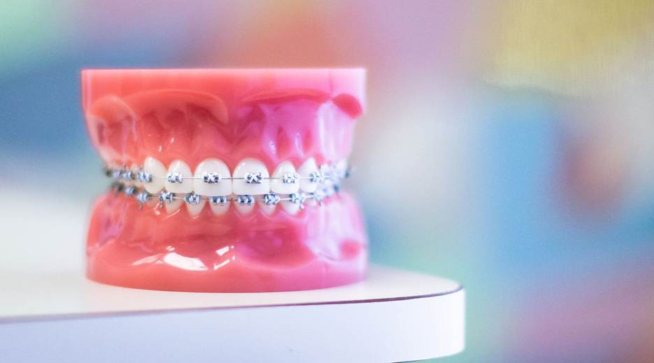 Orthodontics & Alignment