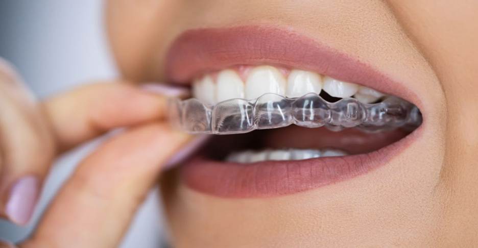 Orthodontics & Alignment