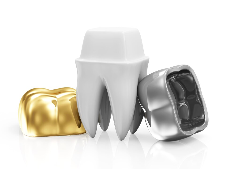 Dental Crowns