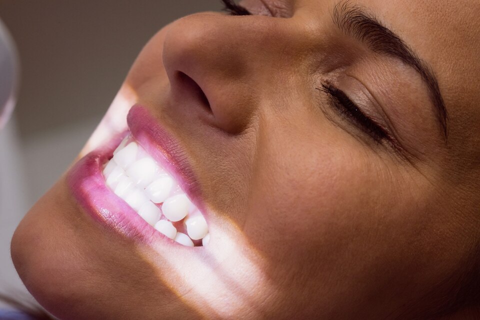 Affordable Veneers in Kenya