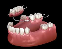 Dentures in Kenya